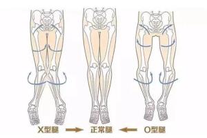 一介粗人·腿型矫正视频教程