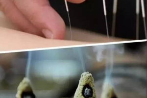 付世德针灸_复合针灸15种病症临床诊疗技巧特训营