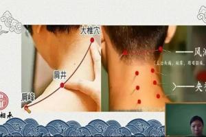医脉相承·王瑶：中医十五组特效针灸教学
